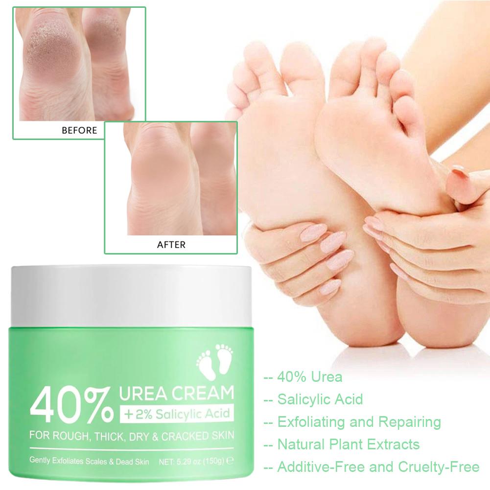 Urea Foot Cream - 40% Urea Cream for Hands and