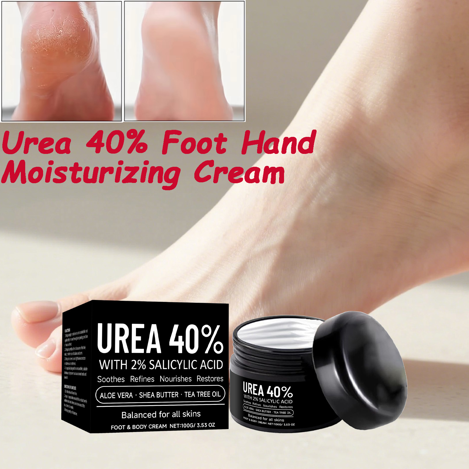 Urea Foot Cream - Urea40% Hand Foot Moisturizing Cream Exfoliating