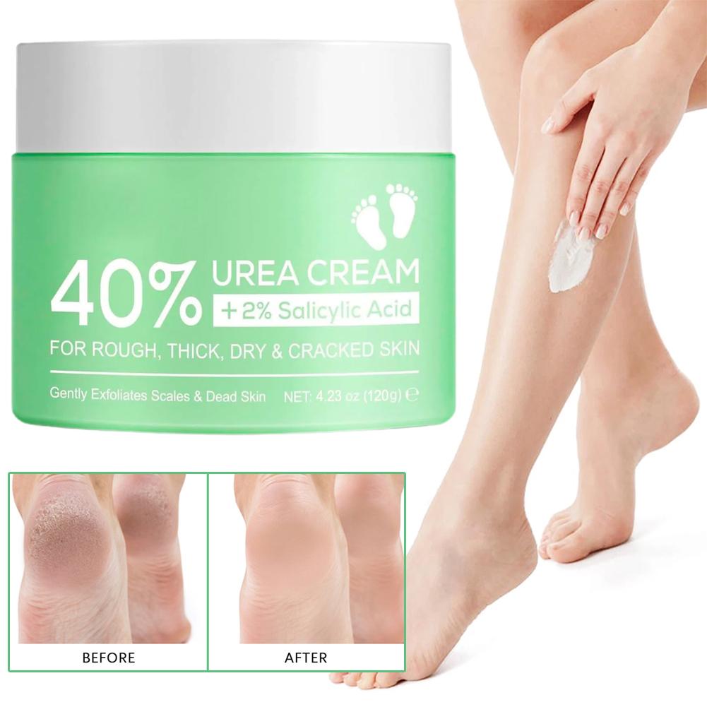 40% Urea Cream for Hands and F – обзор и цена Urea Foot Cream