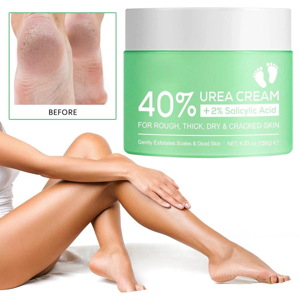 40% Urea Cream for Hands and F – обзор и цена Urea Foot Cream