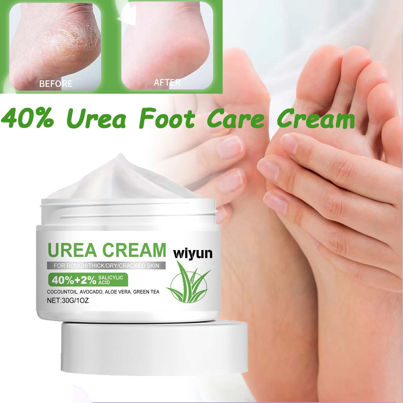 40% Urea Foot Care Cream Overn – обзор и цена Urea Foot Cream