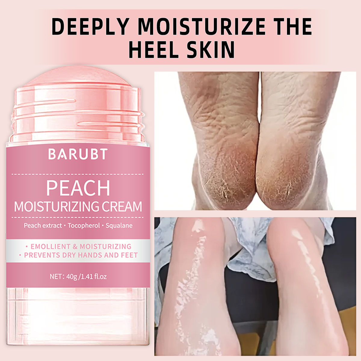 Peach urea mud film rod, salic – обзор и цена Urea Foot Cream