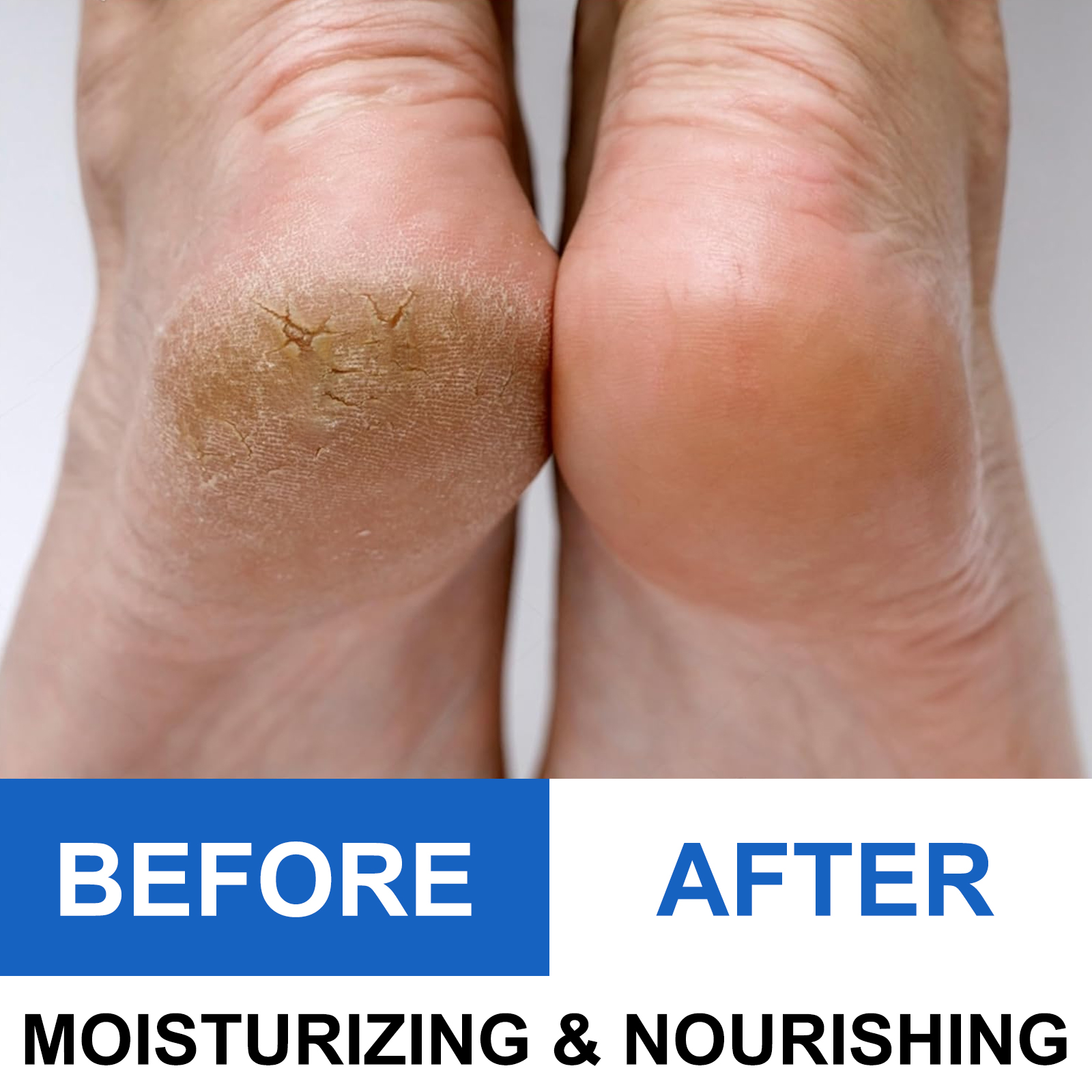 40% Urea Foot Cream Stick - Mo – обзор и цена Urea Foot Cream